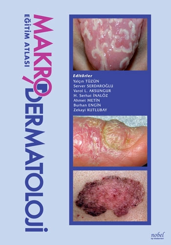 Makro Dermatoloji Eğitim Atlası